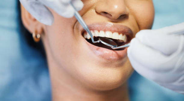 Best Broken or Cracked Tooth Emergency Dentist in Powdersville, SC